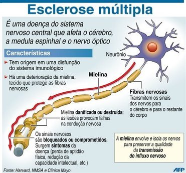 esclerose